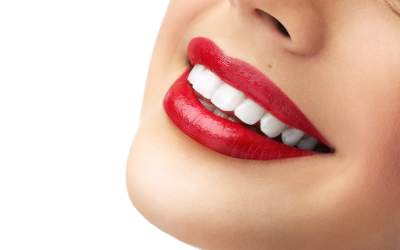 Albirea dinților acasă – 5...