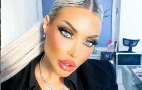 Loredana Chivu a pierdut prima luptă în instanță cu medicul care i-a distrus posterioriul