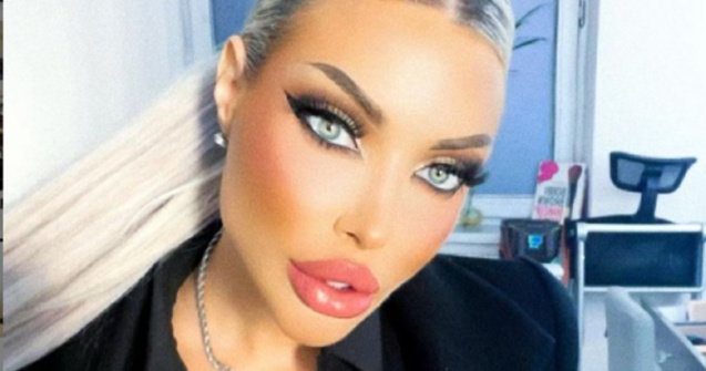 Loredana Chivu a pierdut prima luptă în instanță cu medicul care i-a distrus posterioriul