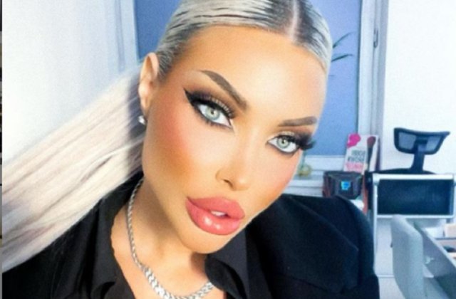 Loredana Chivu a pierdut prima luptă în instanță cu medicul care i-a distrus posterioriul