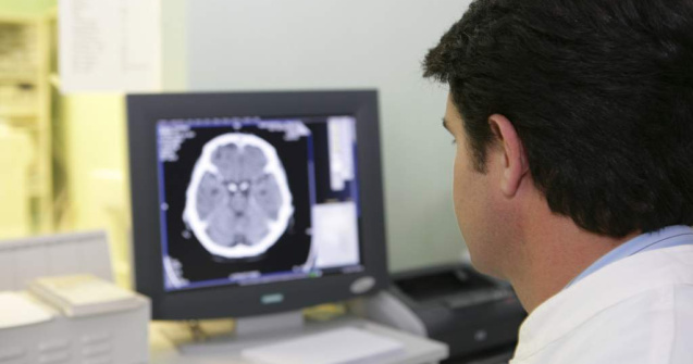 10 experimente fascinante cu creierul tau