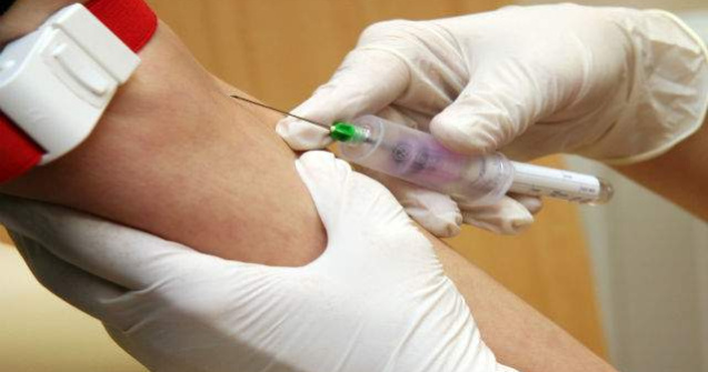 Un test sangvin distinge nodulii pulmonari benigni de cei cancerosi