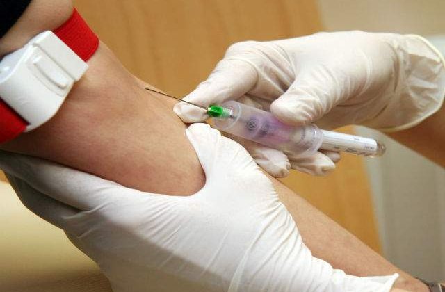 Un test sangvin distinge nodulii pulmonari benigni de cei cancerosi