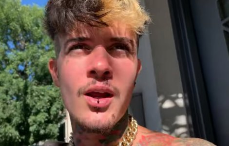 Zanni a apărut cu ochiul vânăt pe Internet, iar fanii au crezut că a fost bătut! Ce i s-a întâmplat, de fapt