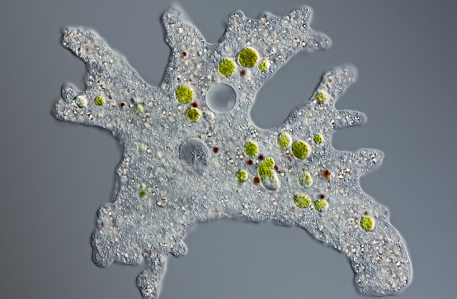 Un copil de 7 ani a murit după ce s-a infectat cu o amibă care se hrănește cu creier uman