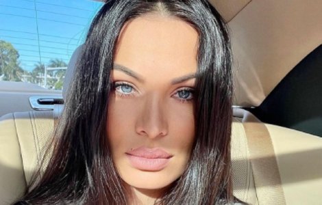 Irisha a dat de probleme în timpul vacanței din Turcia: „Am fost mușcată de...”