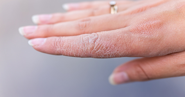  Top  6 moduri de a vă salva mâinile uscate în condiții casnice