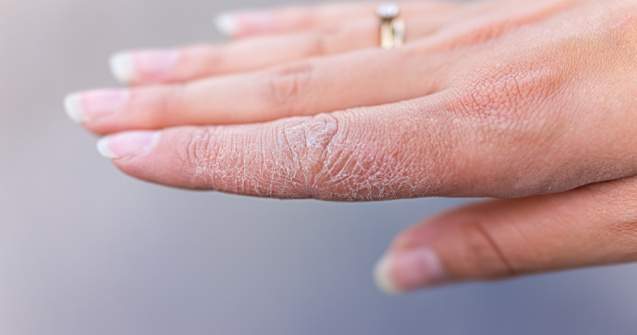  Top  6 moduri de a vă salva mâinile uscate în condiții casnice