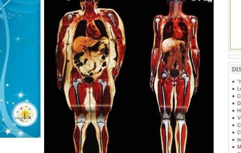 Corpuri scanate: O femeie de 114 kg vs. o femeie de 54 kg