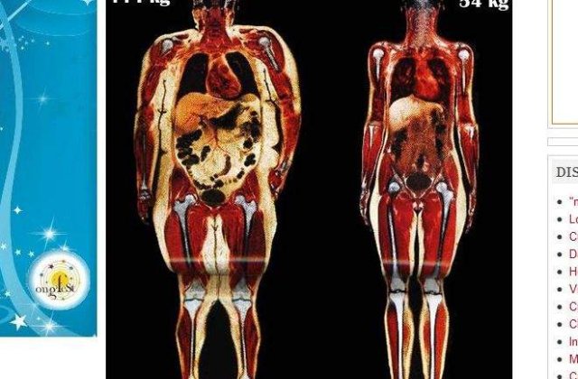 Corpuri scanate: O femeie de 114 kg vs. o femeie de 54 kg