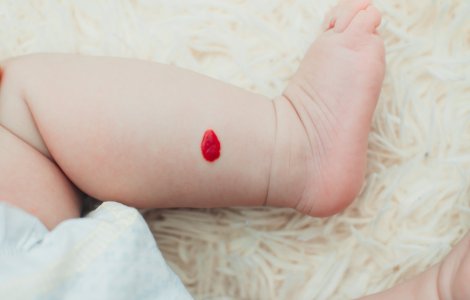  Top  Ce semnifică punctele roșii de pe corp și ce să faci să le previi apariția