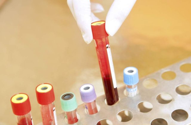 Romania a ramas fara medicamente impotriva HIV