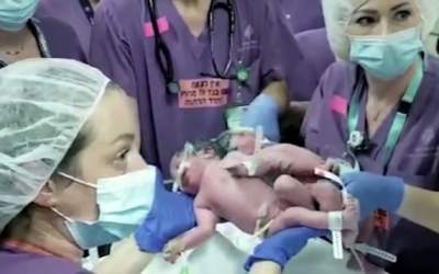 Operația de separare a două...