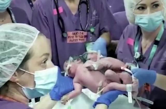 Operația de separare a două fetițe gemene siameze a fost realizată cu succes &icirc;n Israel
