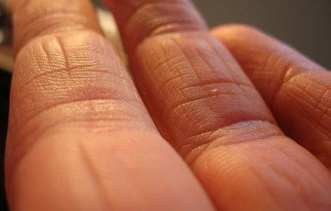 Imbatraneste de cinci ori mai repede decat un copil normal