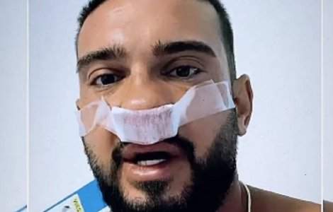 Dorian Popa s-a operat de urgență! Primele declarații ale artistului: „Uitați-vă ce a ieșit...”