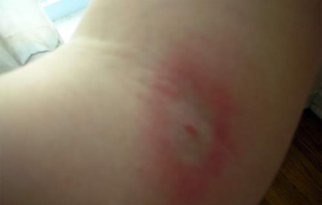 O tanara acuza consulul Cubei la Oslo ca a muscat-o