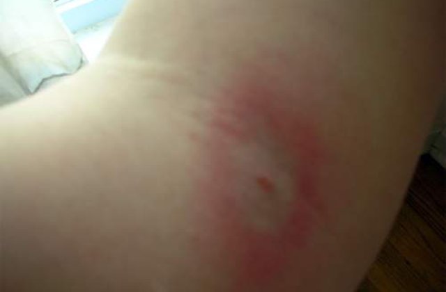 O tanara acuza consulul Cubei la Oslo ca a muscat-o