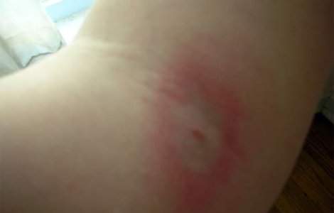 O tanara acuza consulul Cubei la Oslo ca a muscat-o