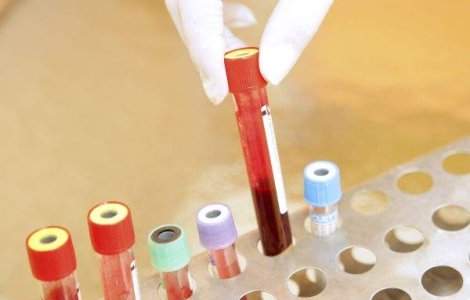 Astrologia japoneza a sangelui: Sexualitatea masculina si grupele sanguine