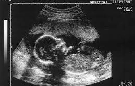 O femeie din India a trecut prin 10 avorturi intr-o singura noapte