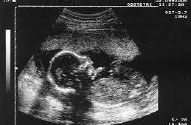 O femeie din India a trecut prin 10 avorturi intr-o singura noapte