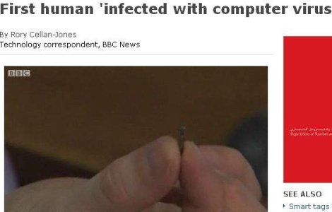  Video  Primul om infectat cu virus de calculator