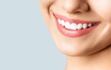 5 soluții pentru un zâmbet de vedetă