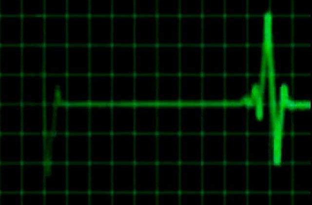 Romanul de 21 de ani, impuscat in cap de un fost carabinier, a murit