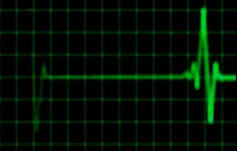 Romanul de 21 de ani, impuscat in cap de un fost carabinier, a murit