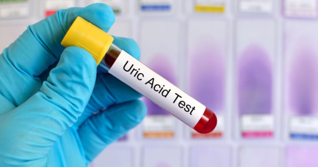 Hiperuricemia - cum gestionezi excesul de acid uric din sânge