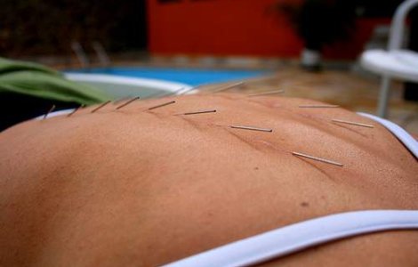 Elvetia: A infectat intentionat cu HIV 15 persoane