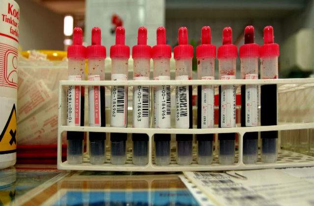 Sute de analize medicale pentru depistarea HIV, falsificate intr-un spital din Romania