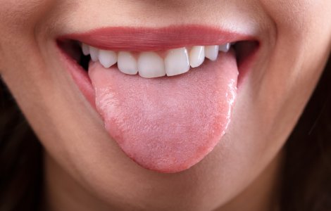 Ce afecțiuni grave ascunde o limbă albă. Care sunt simptomele acestei afecțiuni