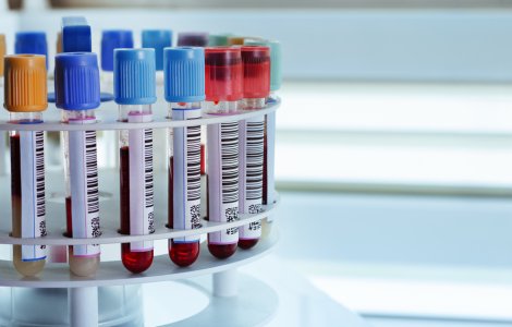 STUDIU: Cercetătorii israelieni au descoperit un sistem anti-cancer din celule umane