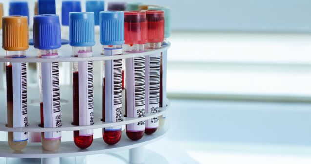 STUDIU: Cercetătorii israelieni au descoperit un sistem anti-cancer