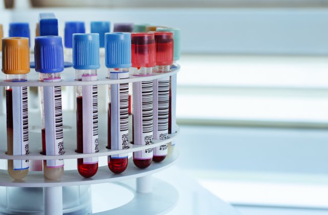 STUDIU: Cercetătorii israelieni au descoperit un sistem anti-cancer din celule umane