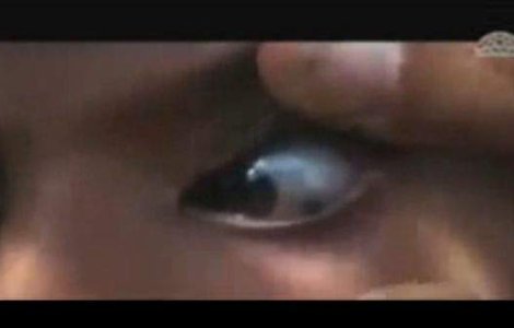  Video  Fata care plange cu pietre a socat lumea medicinei