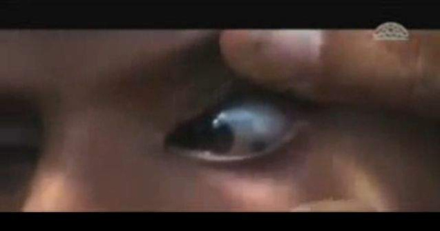  Video  Fata care plange cu pietre a socat lumea medicinei