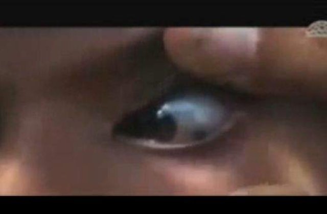 [VIDEO] Fata care plange cu pietre a socat lumea medicinei