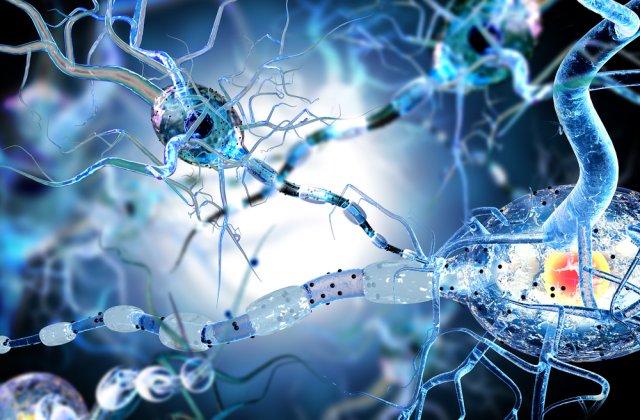 STUDIU: Scleroza multiplă ar putea fi provocată de un virus