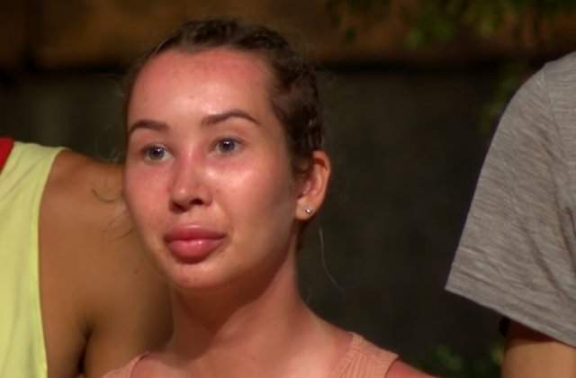 De ce are Xonia fața umflată! Ce probleme de sănătate are fosta concurentă de la Survivor