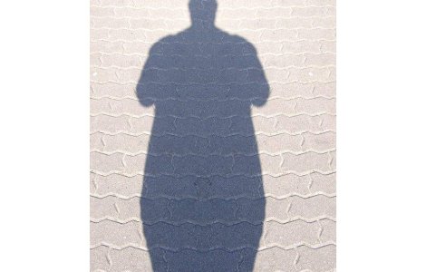 Un roman de 400 de kilograme a murit in ziua in care urma sa fie operat