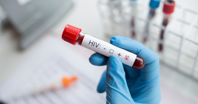 O nouă variantă extrem de violentă de HIV a fost descoperită în Țările de Jos
