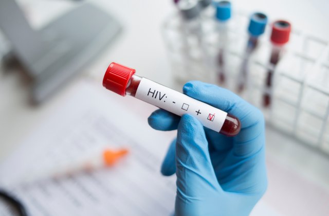 O nouă variantă extrem de violentă de HIV a fost descoperită &icirc;n Țările de Jos