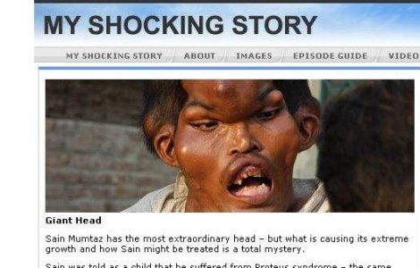 Omul-monstru din Pakistan, unic in lume