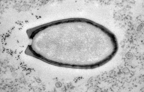 Un virus vechi de peste 30.000 de ani, descoperit in Siberia