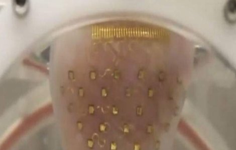  Video  Membrana artificiala pentru mentinerea batailor inimii