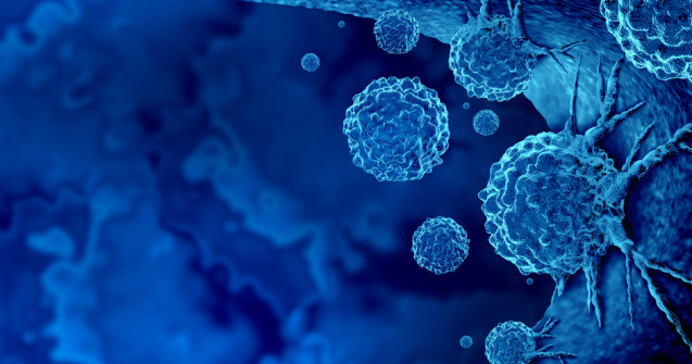 Alimentul magic care scade tensiunea şi previne cancerul