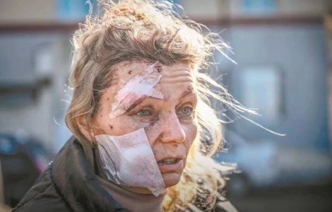Femeia cu chipul insangerat, considerata simbol al razboiului din Ucraina: "Multi nu cred ce se intampla" VIDEO